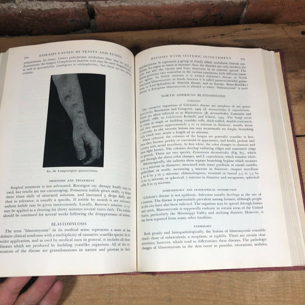 Clinical Tropical Medicine ~ Bercovitz ~ 1944 Vintage Hardback Medical Book